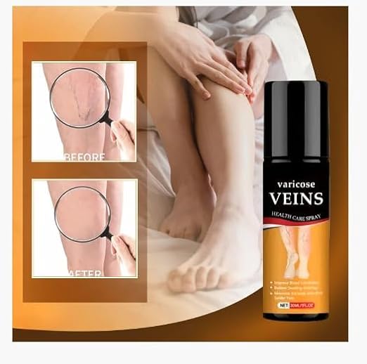 Herbal Varicose Vein Relief Spray 🌿 | Easy Spray-On for Leg Comfort, Swelling & Appearance ✨