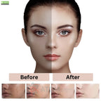 28 Day Whitening Facial Hydrating Cleanser Face Foam Wash 150g